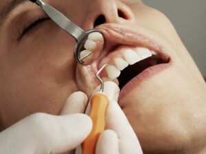 Child dental benefit schemes.