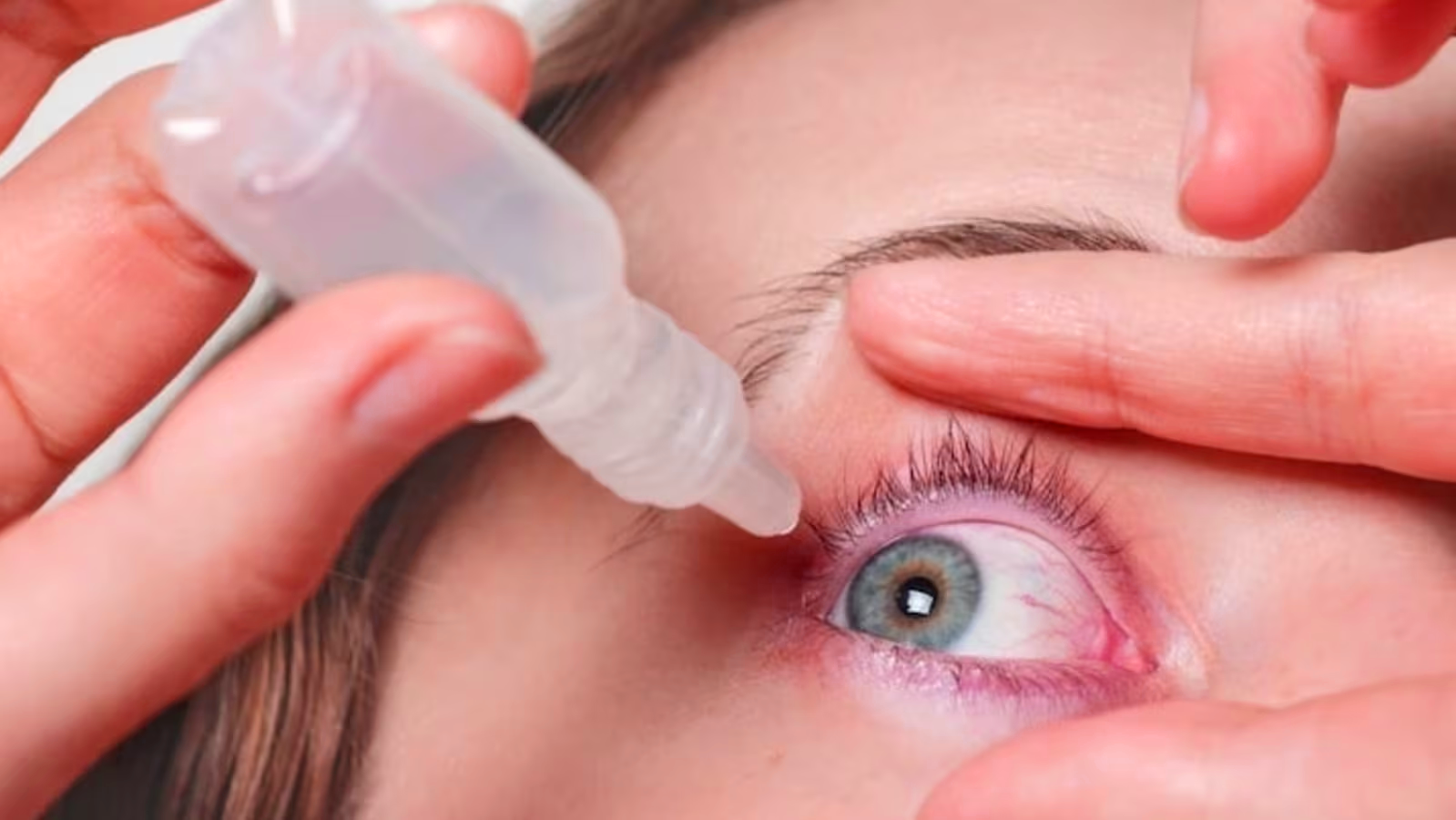 Medication for Eye Flu