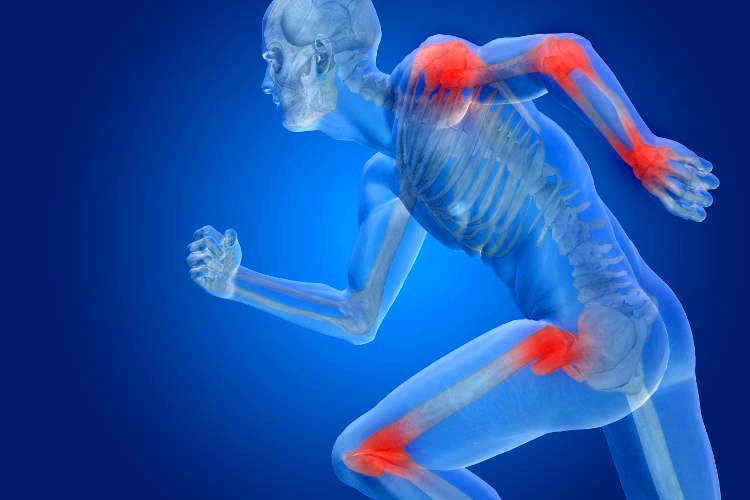 Joint Pain: Causes, Symptoms, and Remedies