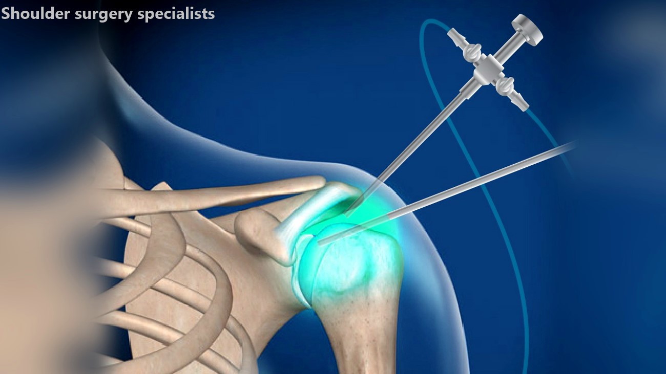 Am I a Candidate for Shoulder Surgery How a Specialist Can Help
