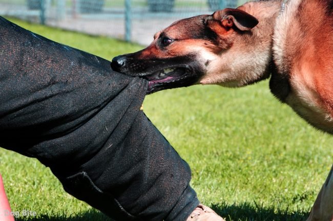 What to Do Immediately After by a Dog Bites?