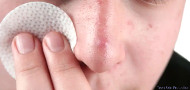 Teen Skin Protection Use these tips for your skin.