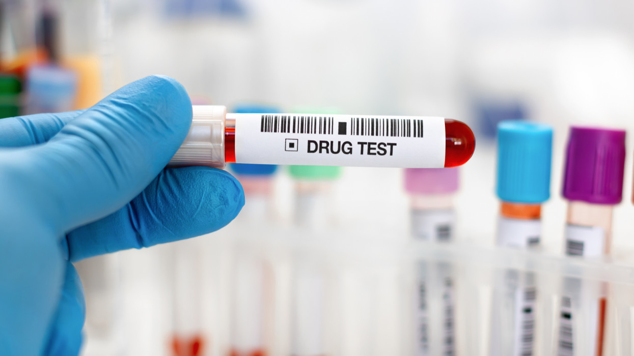 Types of Drug Testing