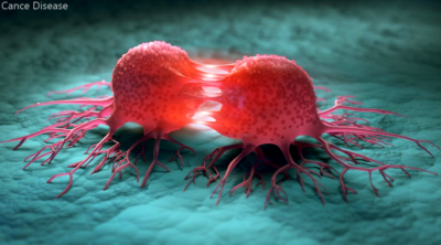 Cancer disease